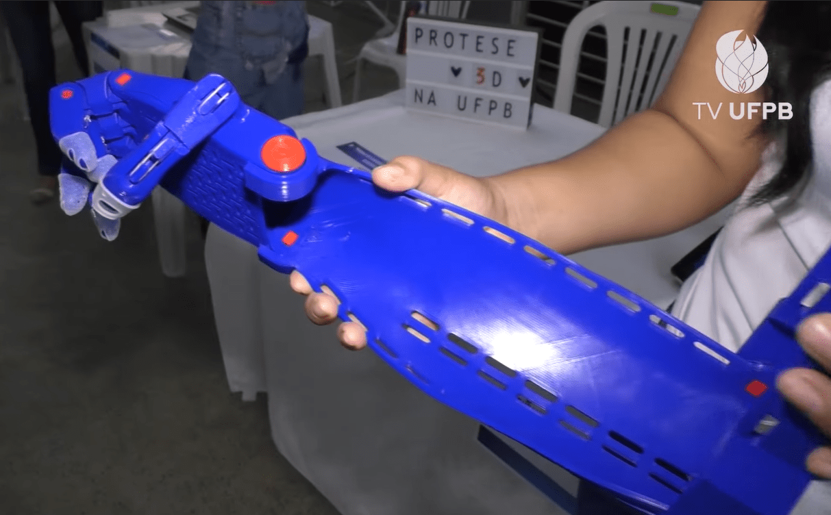 Projeto da UFPB desenvolve prótese de braço de baixo custo
