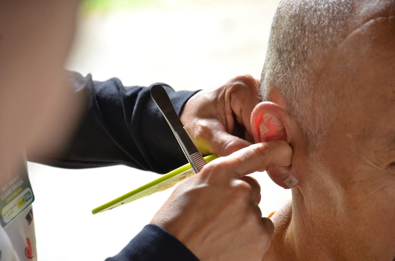 MONKEYPOX: Campina Grande confirma dois novos casos da Varíola dos Macacos