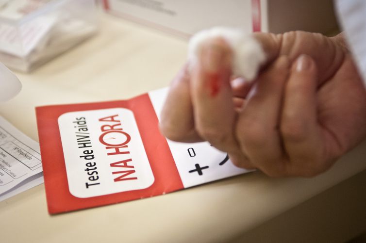 Mortalidade por Aids cai 78% desde 1995 em São Paulo