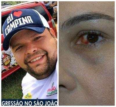 Creci-PB repudia agressão e abre processo administrativo contra corretor acusado por mulheres, em CG